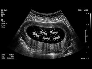 Stomach Scan for Kids | What Happens If You Eat Too Much Junk Food? | Kids Doctor Ultrasound Prank