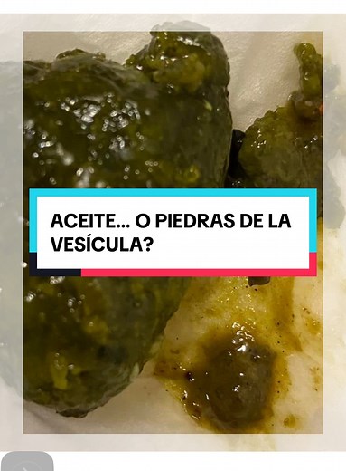 568K views · 7.7K reactions | Muchos siguen diciendo que en la...