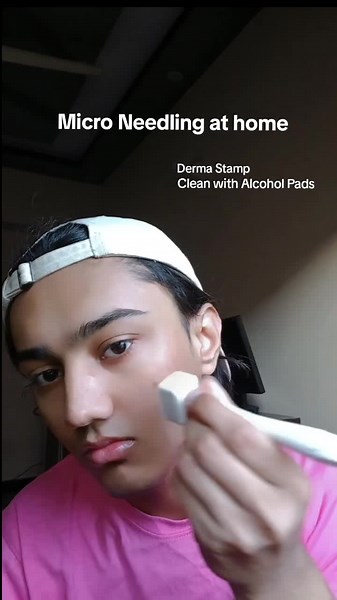 Micro Needling at Home: Step-by-Step Guide