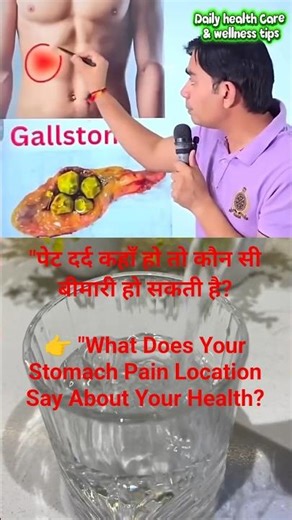 Stomach Pain? This Chart Explains What It Means #medicinetips #healthtips #wellnesstips