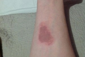 NSPCC warns parents about ‘Salt and Ice Challenge’ dangers - Netmums