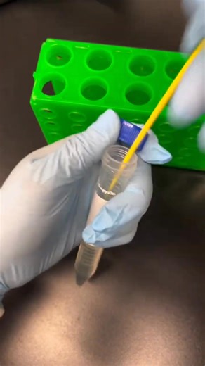 36K views · 493 reactions | Microbiology  #lablife #Microbiology | Lab life | Facebook