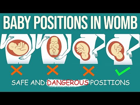 Baby Positions During Pregnancy