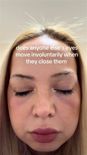 Involuntary Eye Movements: Understanding Twitching