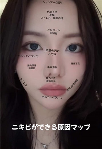 ニキビができる原因を場所別に解説