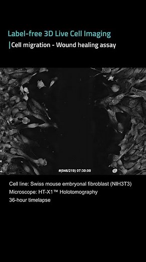 Wound healing assay: Cell movement