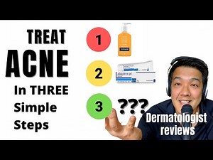 ACNE TREATMENTS | SIMPLIFIED By Dermatologist