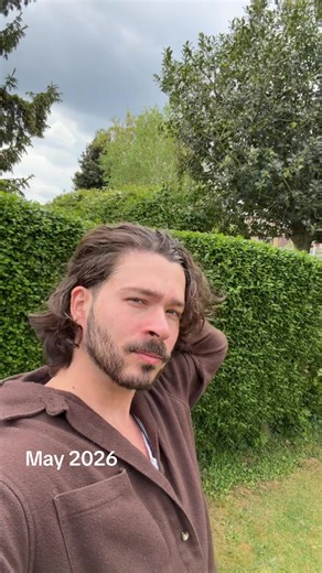 Losing all of my hair to alopecia areata - and all of my hair coming back again #alopeciaareata #alopecia #hairloss
