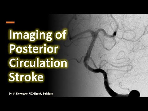 Imaging of Posterior Circulation Stroke - Basilar artery thrombosis and beyond (improved sound)