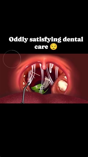 Rose Asmr on Instagram: "Get ready for some relaxing ASMR Animation! 😁🙆🔥 Follow @rose__asmr_ for more Asmr animation videos. Follow | Share | Like #asmr #asmranimation #relaxingvideo #calmingvideos #sleepasmr #satisfyingvideos #stressrelief"