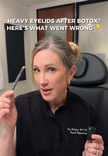 Heavy eyes post-Botox = wrong placement. Between brows = pulls down. Forehead = lifts up. More units between brows, lighter on forehead = the fix. Custom dosing matters. One unit in the wrong place changes everything. Choose your injector wisely. 💉 #Botox #Injectables #AestheticTips