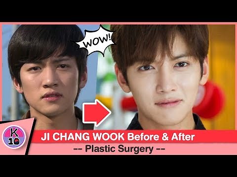 💬 Ji Chang Wook Before and After Plastic Surgery [NETIZEN BUZZ]