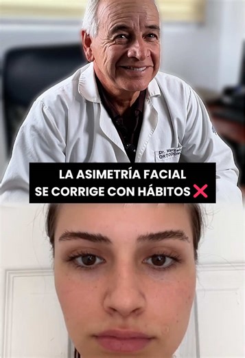 Corrige tu Asimetría Facial con Enfoque UPline