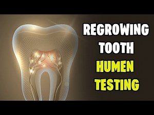 Revolutionary Drug to Regenerate Human Teeth: First Human Trials Begin