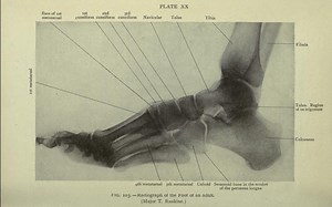 TikTokers are dropping heavy objects on their feet for views