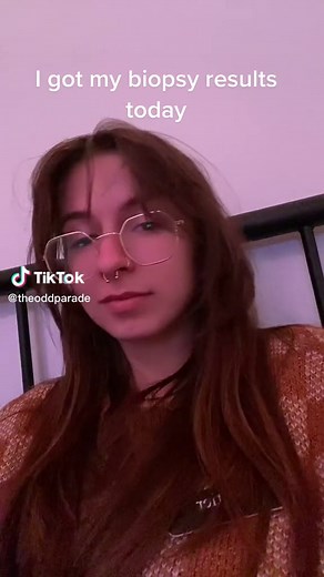 Lymph Node Biopsy Results: Benign and Non-Cancerous!