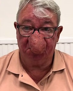 My nose job changed my life 🥹❤️👃 #wholesome | Lessons Learned In Life