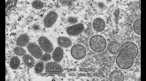 1.1K views · 29 reactions | The number of monkeypox cases has risen to more than 550 in several countries outside Africa, triggering concerns but also claims of unequal attention and treatment. | HOY International Business Channel | Facebook