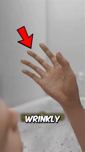Your Fingers Don’t Wrinkle From Water Here’s the Real Reason 😳