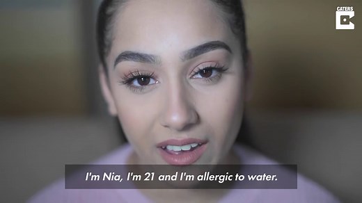 Girl allergic to water gets painful ‘itch’ from one drop of rain