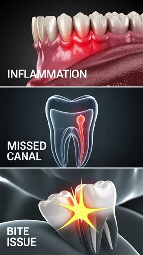 Why Does My Tooth Hurt Even After a Root Canal? #dentalcare #smiledesigndental #dentalclinic