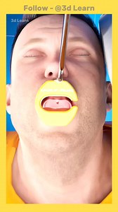 184K views · 551 reactions | Know How Stomach Reduction Surgery Works ?樂 #trendingreels #silverjwellery #skincaregoals #facebookreel #travelawesome #hardikpandya #WatchNow #famousfood #SkinCareEssentials | 3d Learn | Facebook