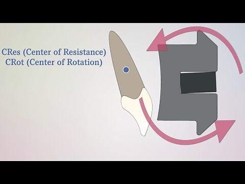 Biomechanics - Types of Tooth Movements in Orthodontics