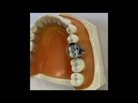 Automatrix system- application