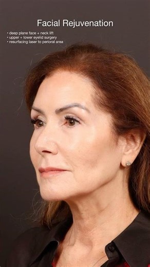 Turning Heads (Facial Rejuvenation)