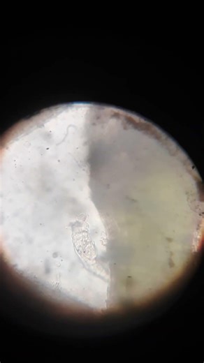 rotifer 💦🔬 #education #microscope #microbiologist #science #nature #science #microbiology #rotifer