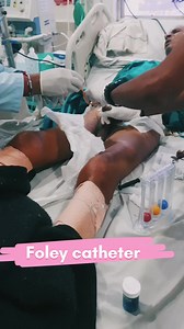 546K views · 2.1K reactions | Foley's catheter✅️ #baby #viral #viralreels #chandututorialeducation | Chandu Tutorial education | Facebook