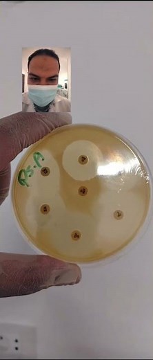 Pseudomonas aeruginosa ampC producing bacteria (Resistant Superbug) #microbiology