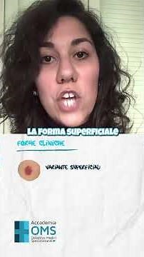 Il basalioma in 60 secondi