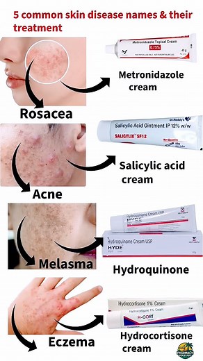 5 Common skin disease name and their treatment#skindiseasenameandtreatment