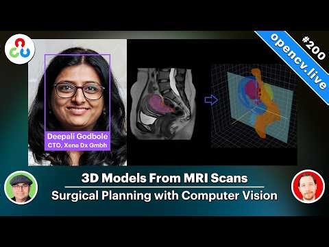 3D Models From MRI Scans, CV For Surgical Planning, and Beyond