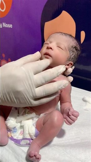 Newborn baby So healthy #nicubaby #baby #newborn #cutebaby #healthybaby