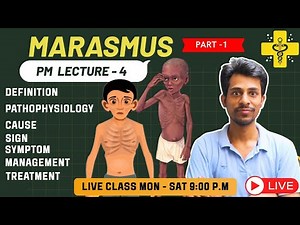 Marasmus – Basic Concept | Protein Energy Malnutrition | Pediatrics | Practice of Medicine