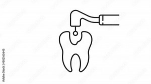 Animated caries linear icon. Dental cavity treatment. Remove decay with dental drill. Seamless loop HD video with alpha channel on transparent background. Outline motion graphic animation vídeo de Stock