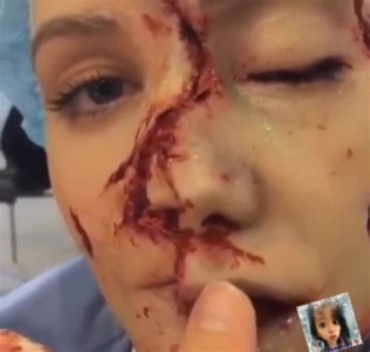 Wtf- Woman's face ripped apart.