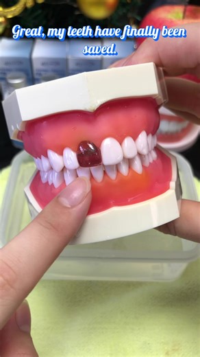 Self-Repair Missing Teeth with Temporary Dental Adhesive