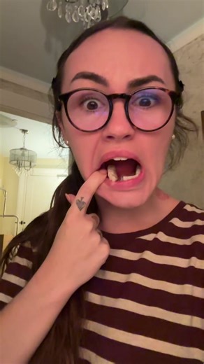 Dental Mishap: Broken Temporary Set & Tomorrow's Appointment