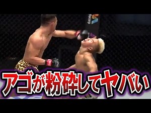 【悲惨な末路…】エグすぎる骨折！史上最悪な事●試合１０選