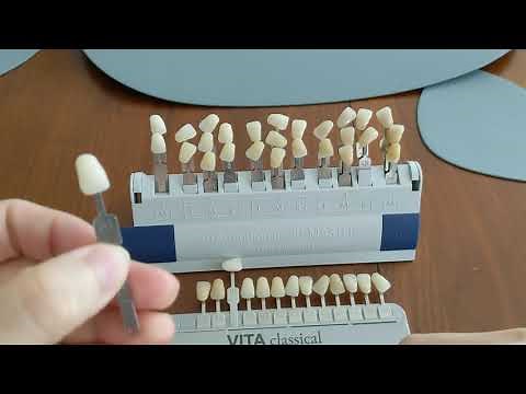 Is A1 tooth shade too white