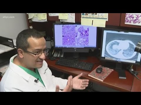 Cleveland Clinic research says vaping THC causes lung damage