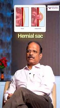 What is an Umbilical Hernia? Causes, Symptoms & Treatment | Dr. Arasu | Sree Renga Hospital