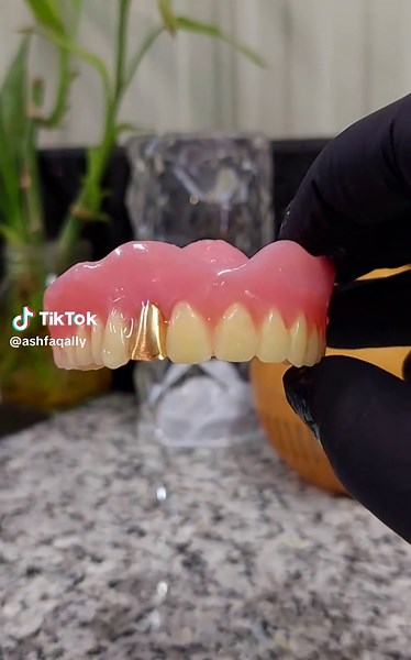 Upper Full Denture Care and Tips for Users