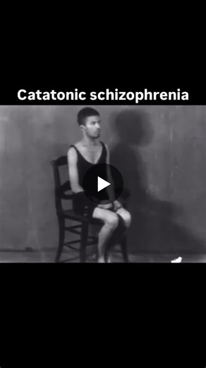Waxy flexibility -- a hallmark symptom of catatonic schizophrenia where a person s limbs can be moved into and held in various positions. Fascinating and haunting all at once...🕯🕵‍♂️ | hira Khan