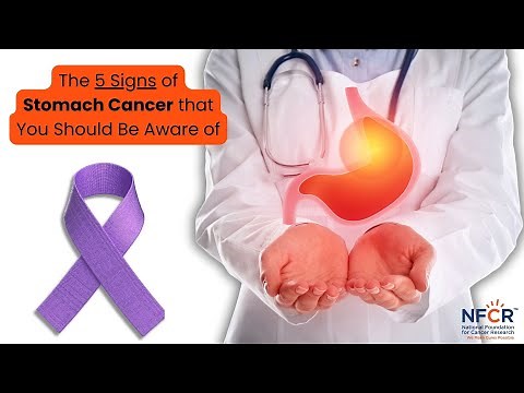 The 5 Signs and Symptoms of Stomach Cancer that You Should be Aware of