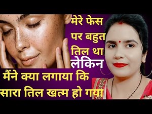 फेस के तिल हटाने का घरेलू नुस्खा || Chehre Ka Til Hatane ka Tarika || Til Kaise Hataye Face ka👍