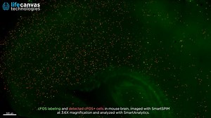 c-FOS labeling and cell detection in mouse brain